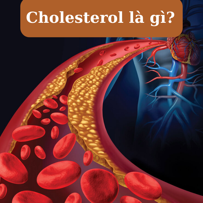 Hướng dẫn cách kiểm soát Cholesterol phòng ngừa đột quỵ và bảo vệ tim mạch