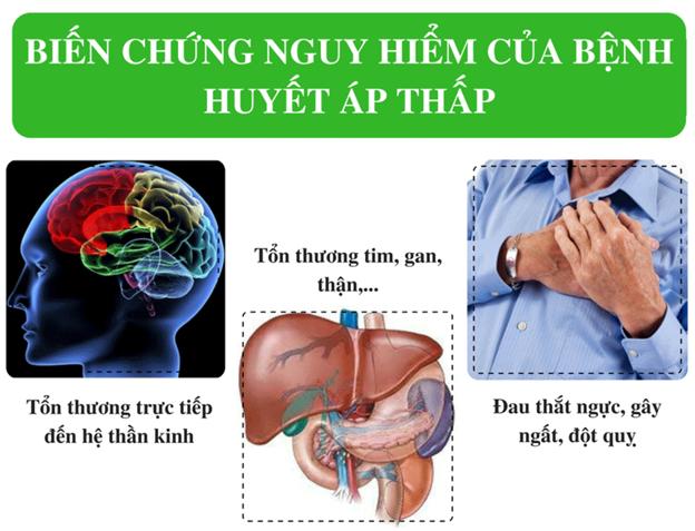 Huyết áp thấp gây đột quỵ: Nguyên nhân, dấu hiệu, cách phòng ngừa