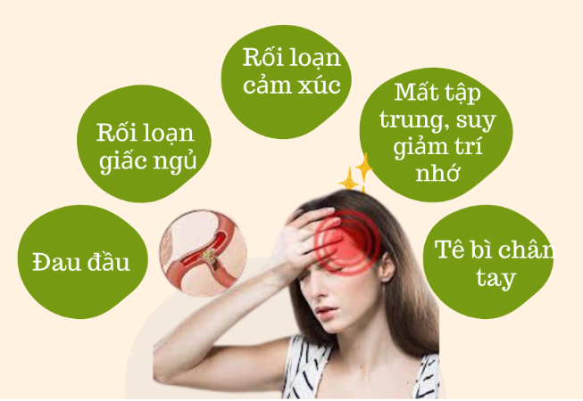 Đau đầu do thiểu năng tuần hoàn não: Nguyên nhân, biểu hiện, cách điều trị hiệu quả